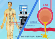 人和醫(yī)院 尿潴留、尿失禁動(dòng)畫(huà)